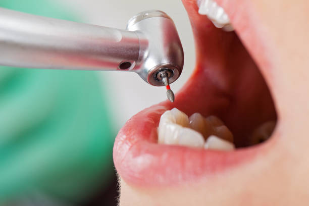 Best Urgent Care for Lost Fillings or Crowns in Palmyra, WI